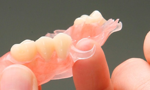 Vizil proteza sa atačmentima